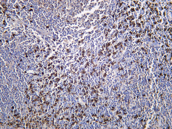 Recombinant Desmoglein 3/PVA Monoclonal Antibody (AGEL6824)