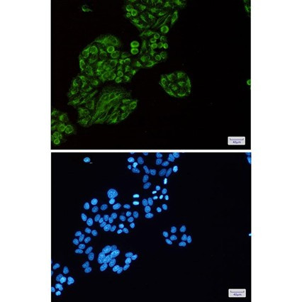 Recombinant Tec Monoclonal Antibody (AGEL6827)