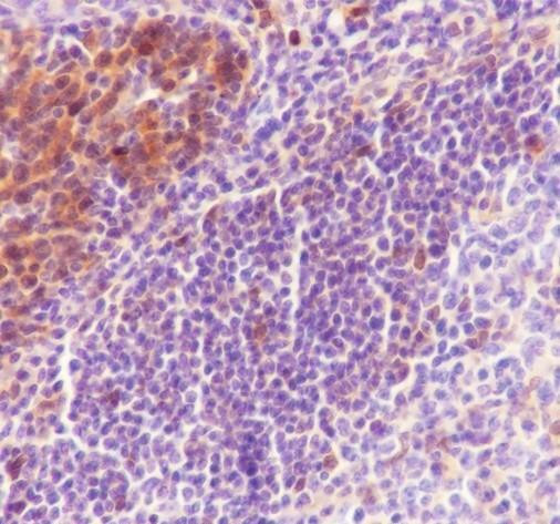 Recombinant TMS1/ASC Monoclonal Antibody (AGEL6829)