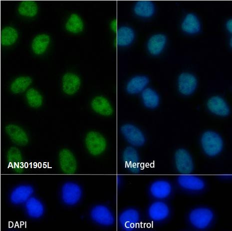 Recombinant MBD2 Monoclonal Antibody (AGEL6831)