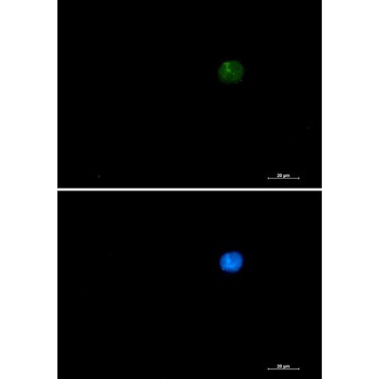 Recombinant SMARCA2/BRM Monoclonal Antibody (AGEL6834)