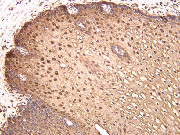 Recombinant IL-1RA Monoclonal Antibody (AGEL6838)