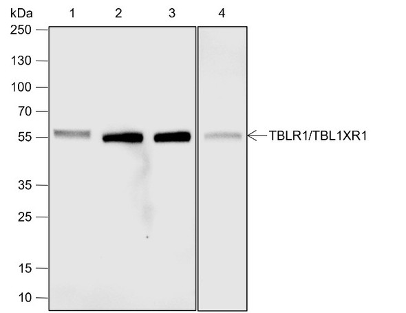 Recombinant TBLR1/TBL1XR1 Monoclonal Antibody (AGEL6850)