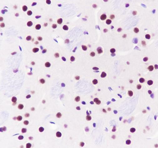 Recombinant TBLR1/TBL1XR1 Monoclonal Antibody (AGEL6850)