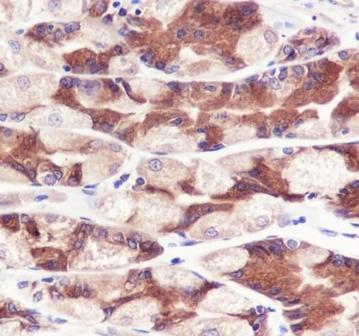 Recombinant PGRMC2 Monoclonal Antibody (AGEL6852)
