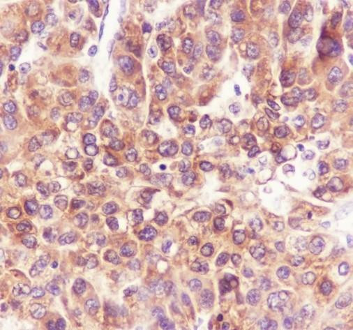 Recombinant PGRMC2 Monoclonal Antibody (AGEL6852)
