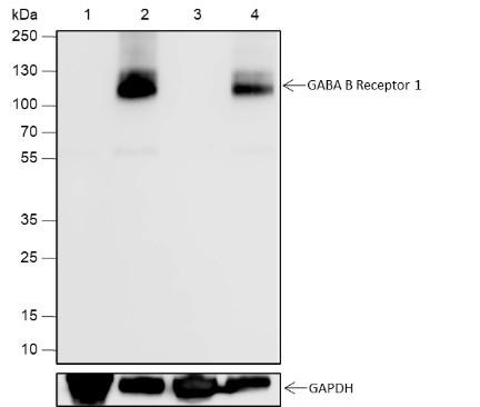 Recombinant GABA B Receptor 1 Monoclonal Antibody (AGEL6860)