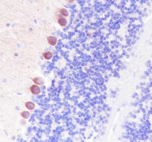 Recombinant GABA B Receptor 1 Monoclonal Antibody (AGEL6860)