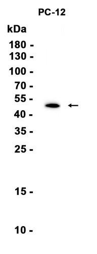 Recombinant beta III Tubulin Monoclonal Antibody (AGEL6861)