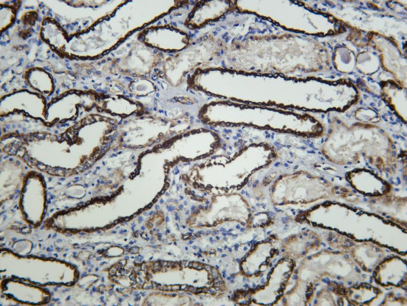 Recombinant SLC16A1 Monoclonal Antibody (AGEL6863)