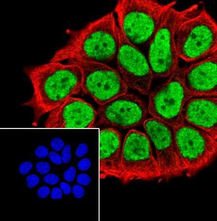 Recombinant RXRA Monoclonal Antibody (AGEL6869)