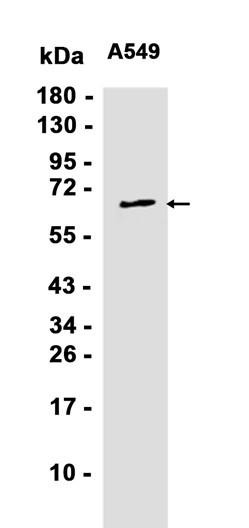 Recombinant RPA70 Monoclonal Antibody (AGEL6872)