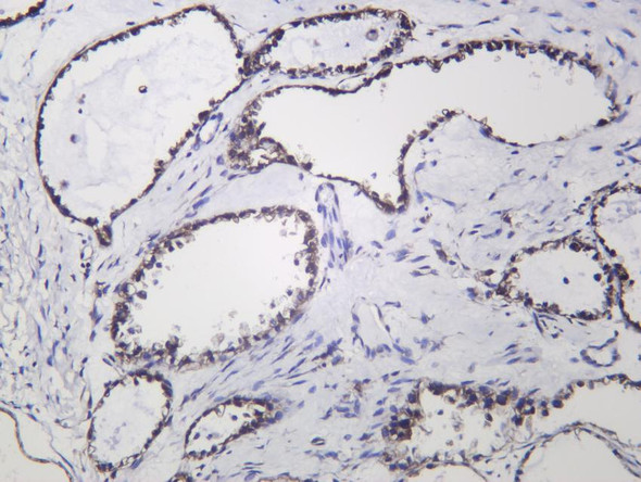 Recombinant eIF4G1 Monoclonal Antibody (AGEL6879)