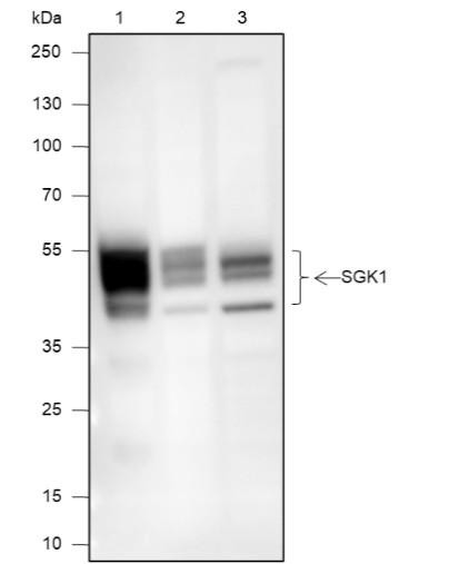 Recombinant SGK1 Monoclonal Antibody (AGEL6880)