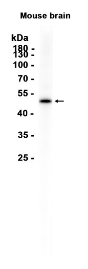 Recombinant Perilipin-2 Monoclonal Antibody (AGEL6881)