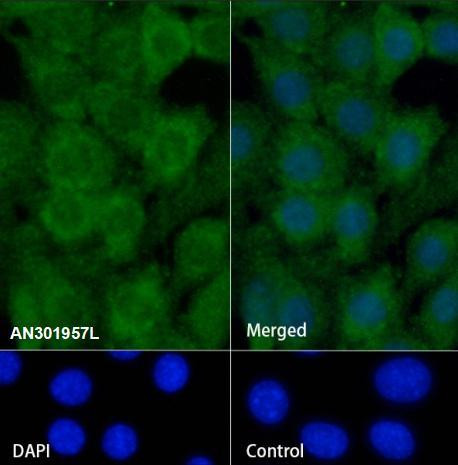 Recombinant RPS3 Monoclonal Antibody (AGEL6883)
