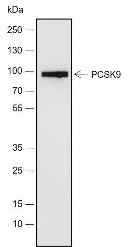 Recombinant PCSK9 Monoclonal Antibody (AGEL6884)
