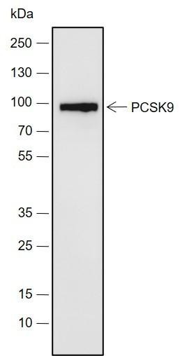 Recombinant PCSK9 Monoclonal Antibody (AGEL6884)