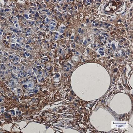 Recombinant Creatine kinase B type Monoclonal Antibody (AGEL6889)