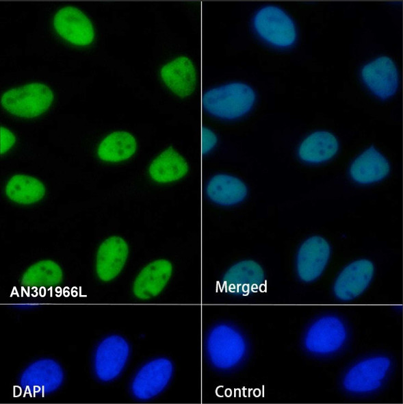 Recombinant SP1 Monoclonal Antibody (AGEL6892)