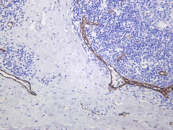 Recombinant Von Willebrand Factor Monoclonal Antibody (AGEL6893)