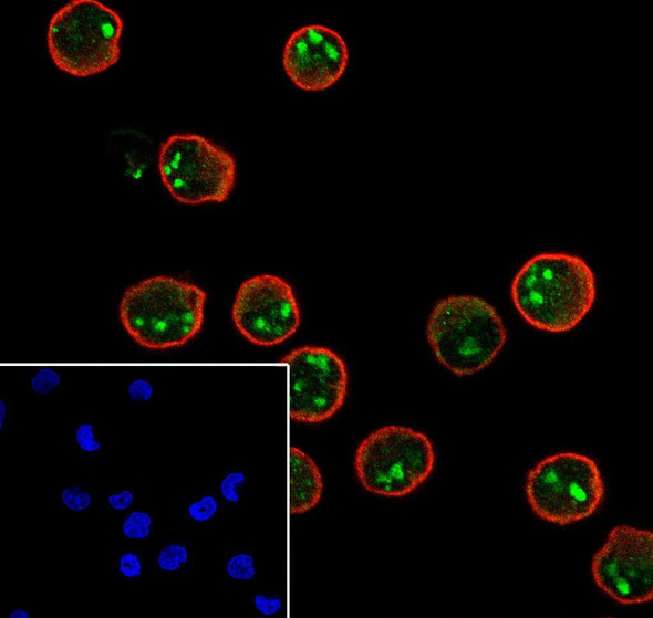 Recombinant TOP3B Monoclonal Antibody (AGEL6900)