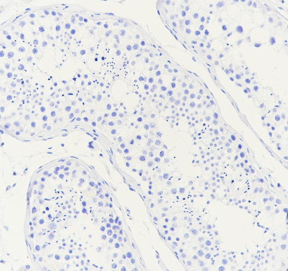 Recombinant Dopamine beta Hydroxylase Monoclonal Antibody (AGEL6901)