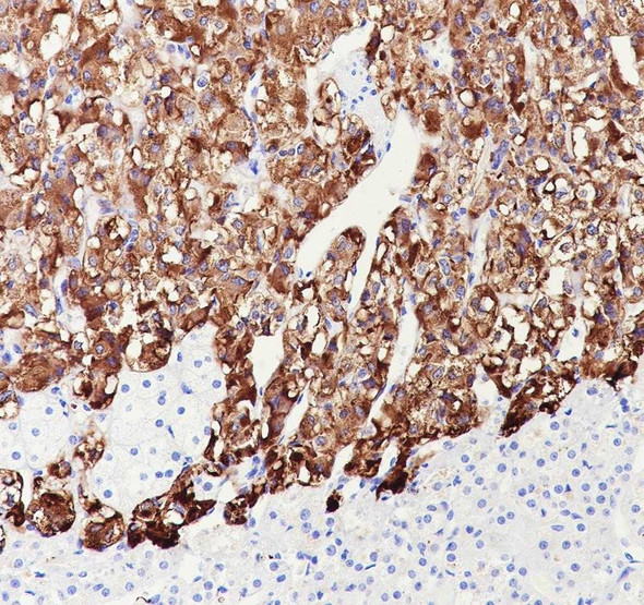 Recombinant Dopamine beta Hydroxylase Monoclonal Antibody (AGEL6901)