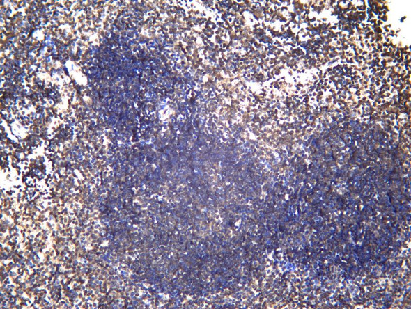 Recombinant CD272/BTLA Monoclonal Antibody (AGEL6903)