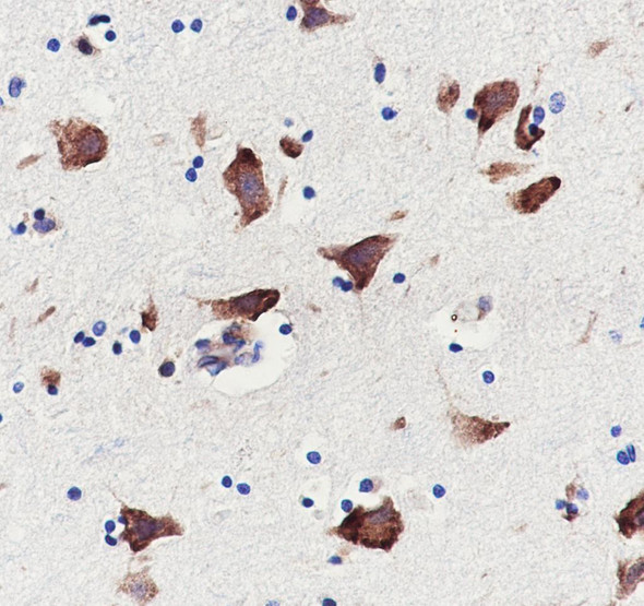 Recombinant eEF1A2 Monoclonal Antibody (AGEL6905)