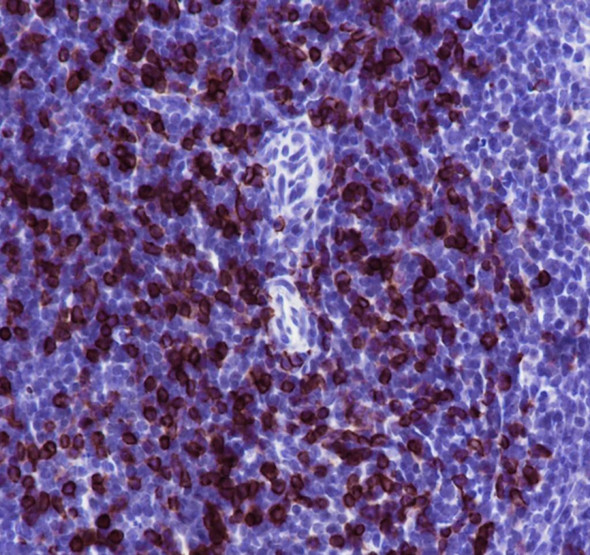 Recombinant CD8 beta Monoclonal Antibody (AGEL6908)