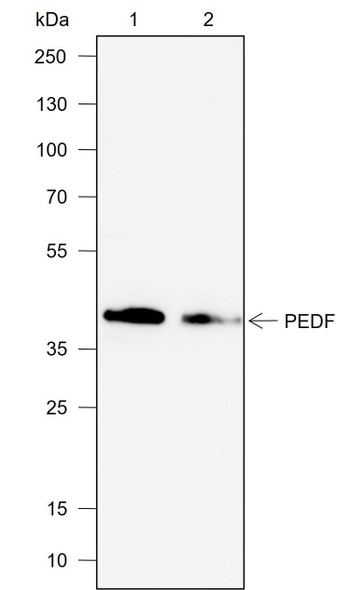Recombinant PEDF Monoclonal Antibody (AGEL6910)