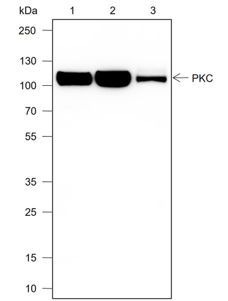 Recombinant PKC mu Monoclonal Antibody (AGEL6911)