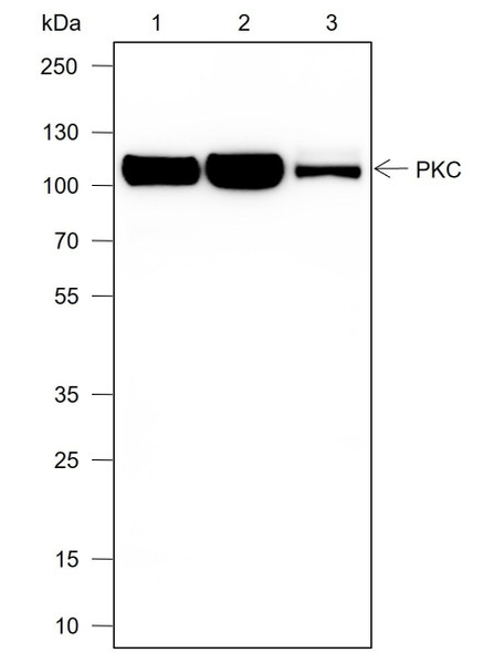 Recombinant PKC mu Monoclonal Antibody (AGEL6911)