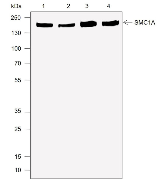 Recombinant SMC1A Monoclonal Antibody (AGEL6912)