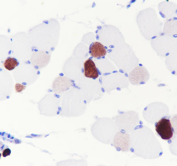 Recombinant MYH7 Monoclonal Antibody (AGEL6913)