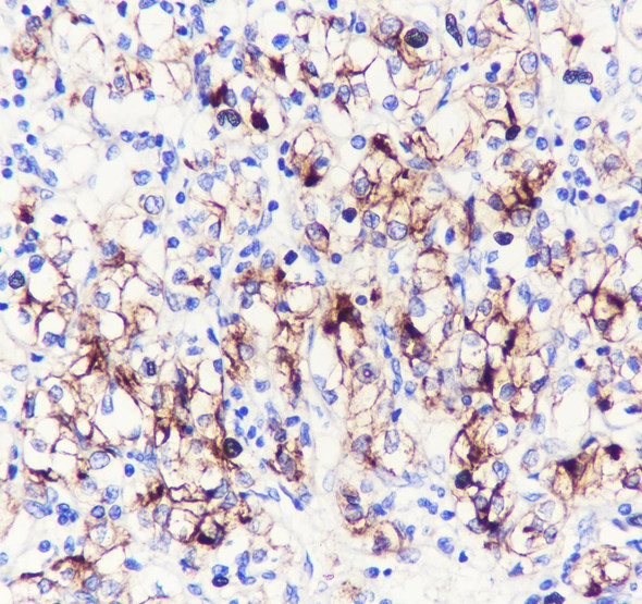 Recombinant ACE2 Monoclonal Antibody (AGEL6914)
