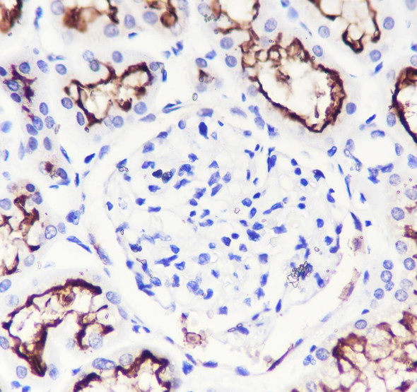 Recombinant ACE2 Monoclonal Antibody (AGEL6914)