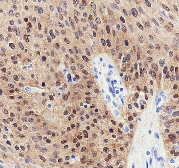 Recombinant CDKN2A/p16INK4a Monoclonal Antibody (AGEL6917)