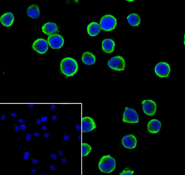 Recombinant DcR1 Monoclonal Antibody (AGEL6922)