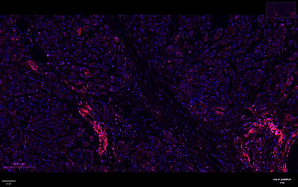 Recombinant PLCG1 Monoclonal Antibody (AGEL6923)