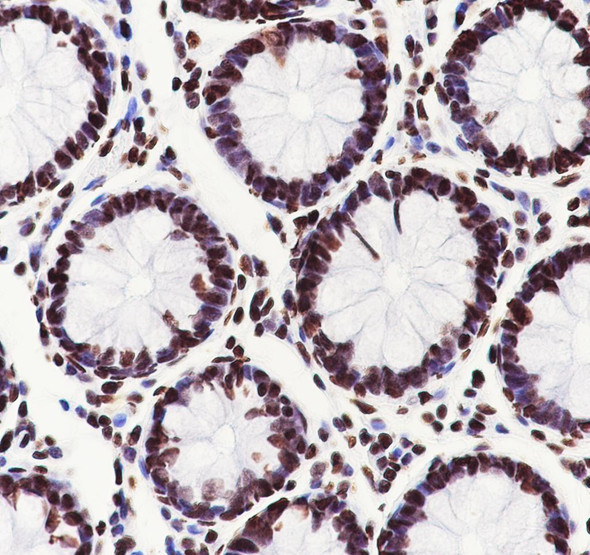 Recombinant Nucleolin Monoclonal Antibody (AGEL6926)
