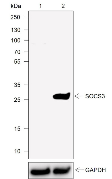 Recombinant SOCS3 Monoclonal Antibody (AGEL6929)