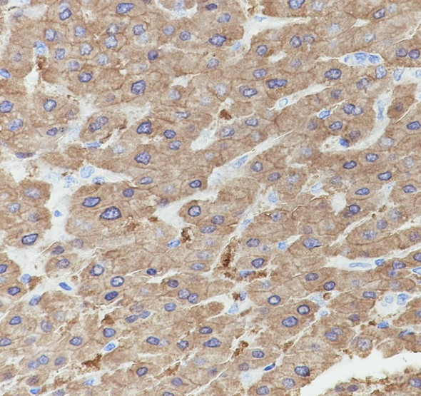 Recombinant Tissue Plasminogen Activator Monoclonal Antibody (AGEL6931)