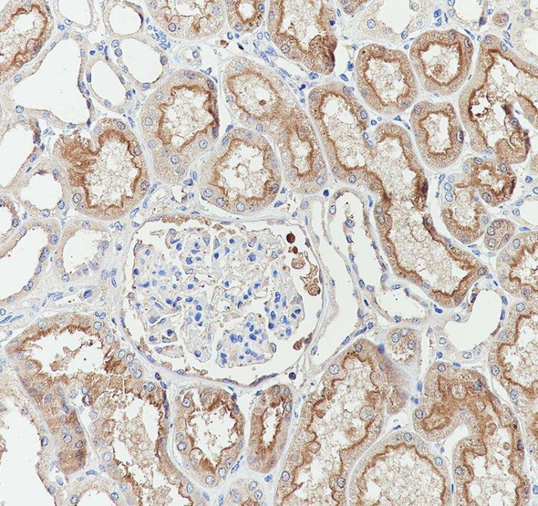 Recombinant EAAT3 Monoclonal Antibody (AGEL6935)