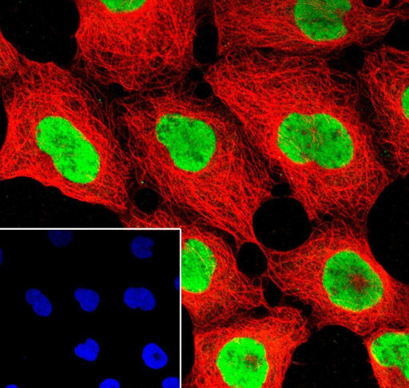 Recombinant CIRBP Monoclonal Antibody (AGEL6937)