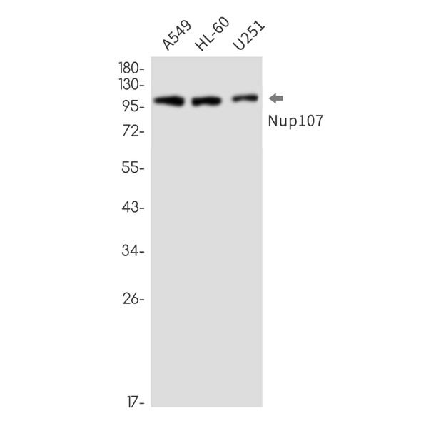 Recombinant NUP107 Monoclonal Antibody (AGEL6938)