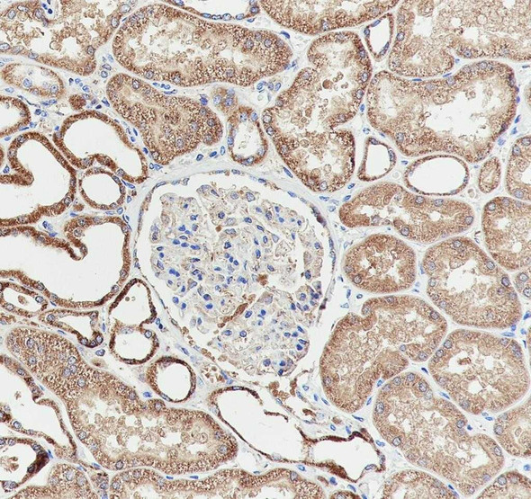 Recombinant SPR Monoclonal Antibody (AGEL6954)