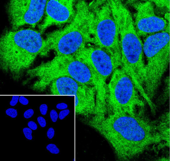 Recombinant SHIP-2 Monoclonal Antibody (AGEL6955)