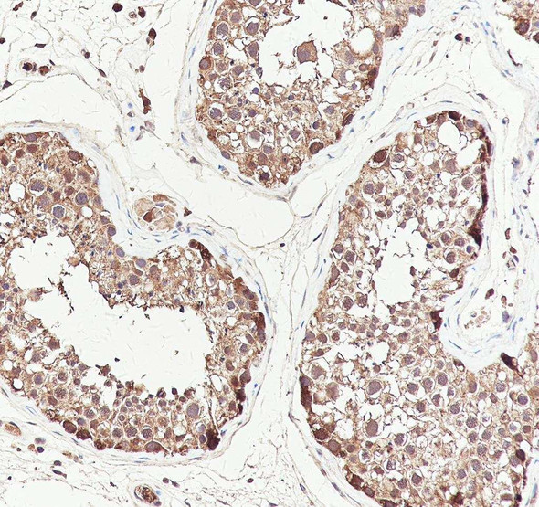 Recombinant EID1 Monoclonal Antibody (AGEL6959)